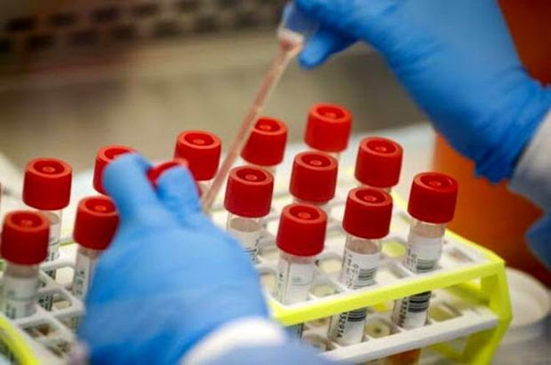 Türkiyəli cütlük koronavirusu üç dəqiqəyə müəyyənləşdirən test ixtira etdi -
