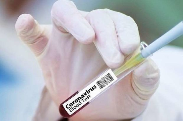 Yaponiyada koronavirus üçün sürətli test hazırlandı -