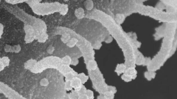Koronavirus hüceyrəsinin yeni görüntüləri: