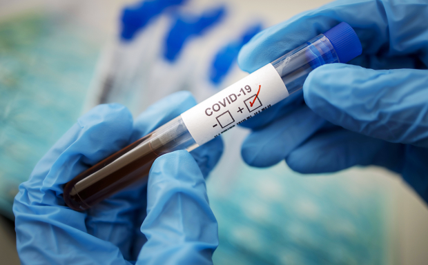 Azərbaycanda koronavirus: