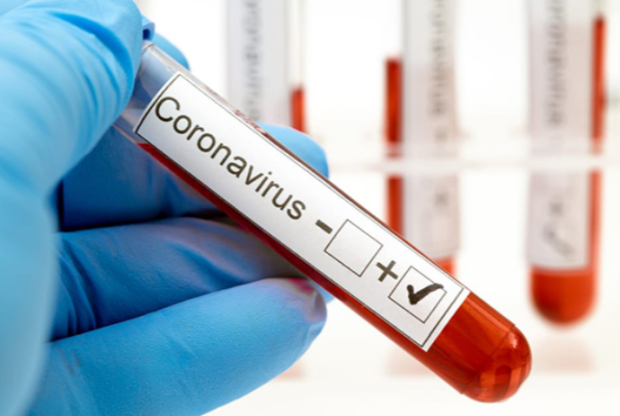 7 nəfər koronavirusa yoluxdu, ölən yoxdur