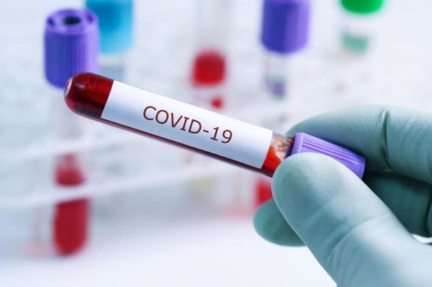 Ukraynada koronavirusun yeni dalğası başlayıb