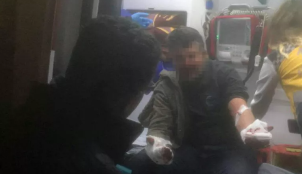 Mübahisə etdiyi iş yoldaşının qulağını kəsdi