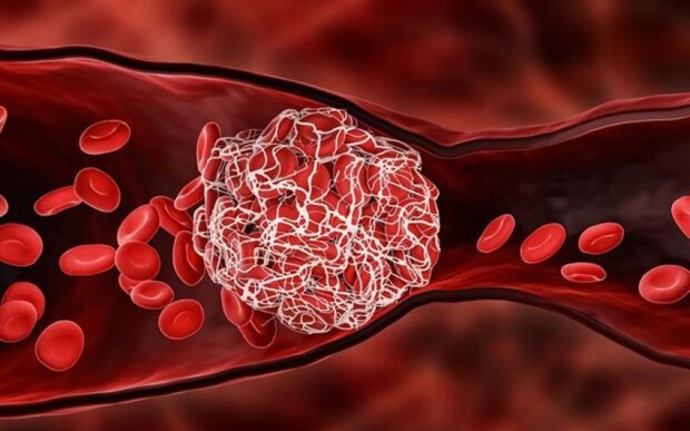 Hematoloq: "Qan durulaşdıran dərmanların nəzarətsiz qəbulu hemofiliyalı xəstələr üçün təhlükəlidir" Hematoloq: "Qan durulaşdıran dərmanların nəzarətsiz qəbulu hemofiliyalı xəstələr üçün təhlükəlidir"