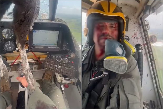 Havada dəhşət: Kabinəyə girən gözlənilməz qonaq pilotu yaraladı